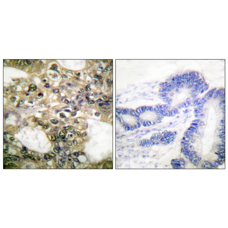 Immunohistochemistry - Anti-HDAC6 Antibody (C0226) - Antibodies.com