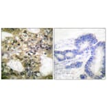 Immunohistochemistry - Anti-HDAC6 Antibody (C0226) - Antibodies.com