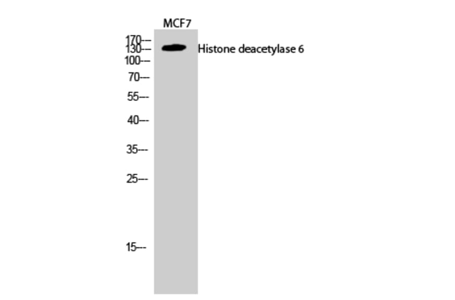 Western Blot - Anti-HDAC6 Antibody (C0226) - Antibodies.com