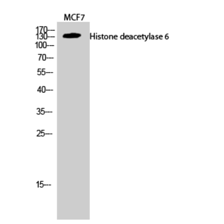 Western Blot - Anti-HDAC6 Antibody (C0226) - Antibodies.com