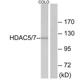 Western Blot - Anti-HDAC5 Antibody (B7101) - Antibodies.com