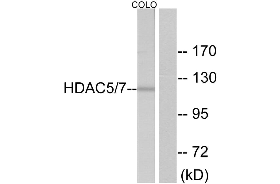 Western Blot - Anti-HDAC5 Antibody (B7101) - Antibodies.com