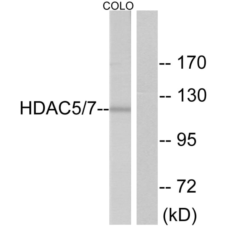 Western Blot - Anti-HDAC5 Antibody (B7101) - Antibodies.com