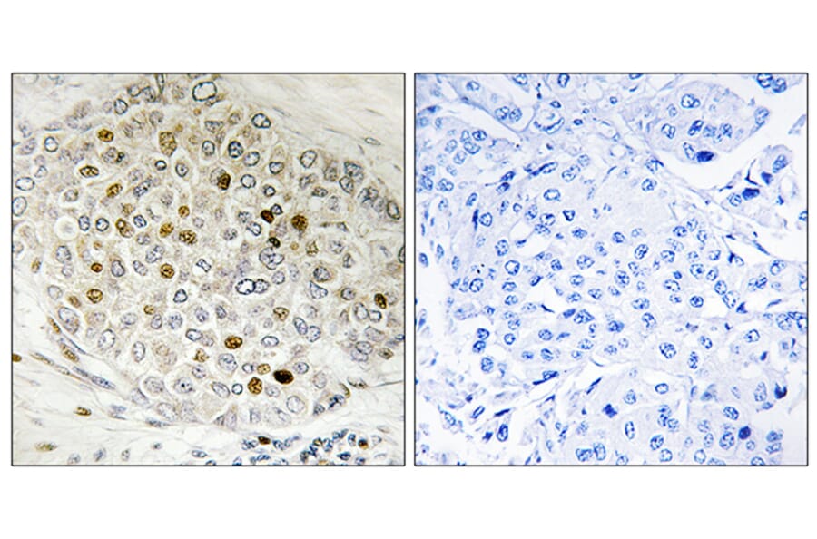 Immunohistochemistry - Anti-HDAC5 Antibody (B7101) - Antibodies.com