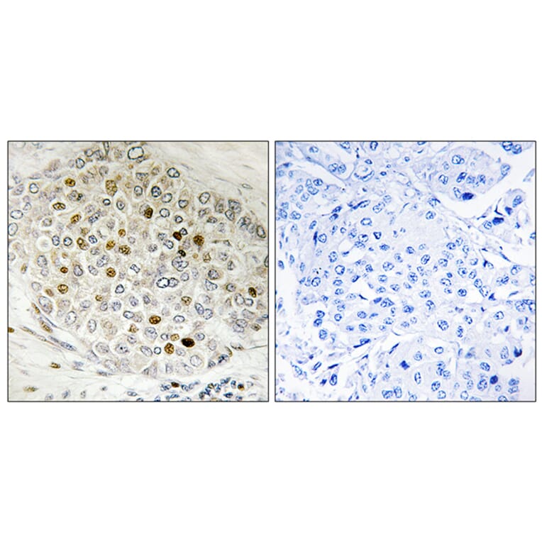 Immunohistochemistry - Anti-HDAC5 Antibody (B7101) - Antibodies.com