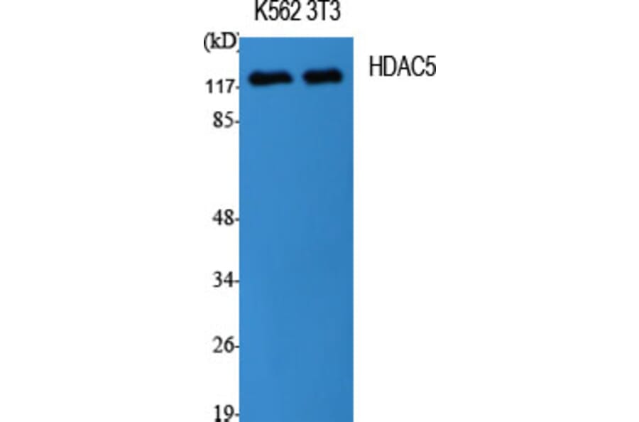 Western Blot - Anti-HDAC5 Antibody (B7101) - Antibodies.com