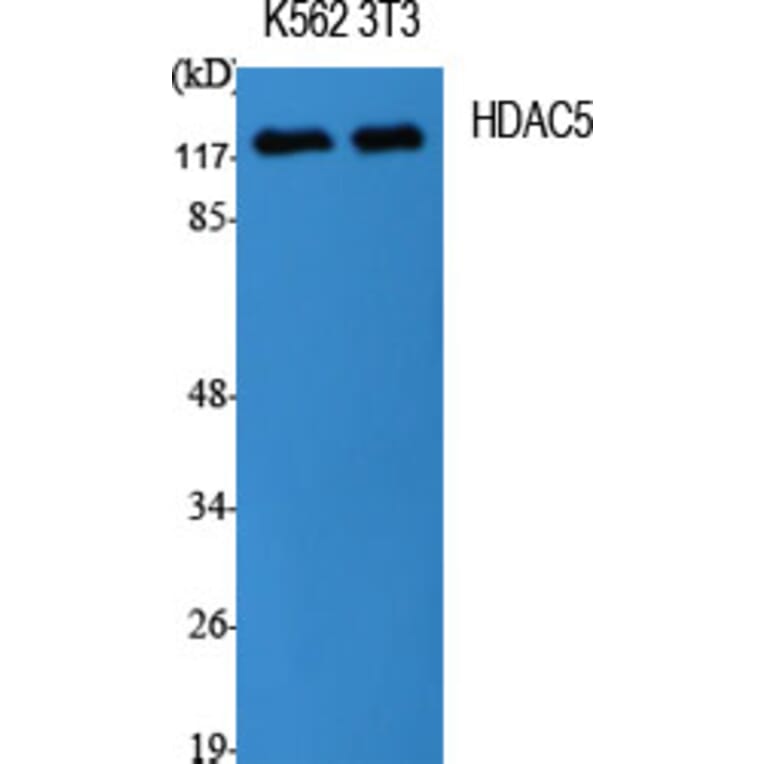 Western Blot - Anti-HDAC5 Antibody (B7101) - Antibodies.com