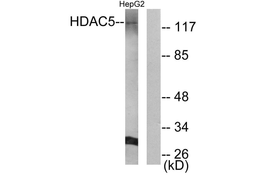 Western Blot - Anti-HDAC5 Antibody (B0436) - Antibodies.com