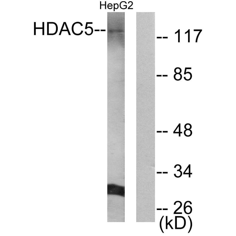 Western Blot - Anti-HDAC5 Antibody (B0436) - Antibodies.com