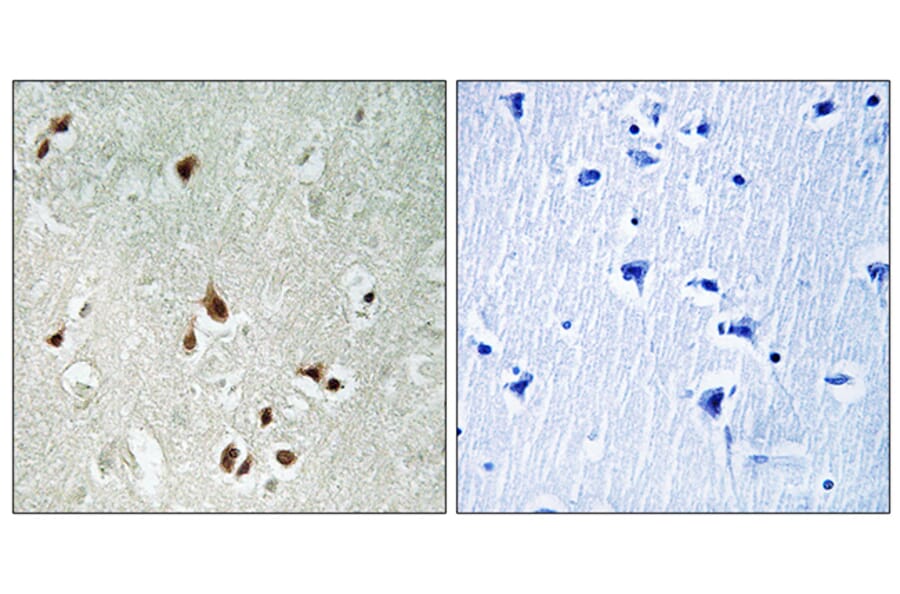 Immunohistochemistry - Anti-HDAC5 Antibody (B0436) - Antibodies.com