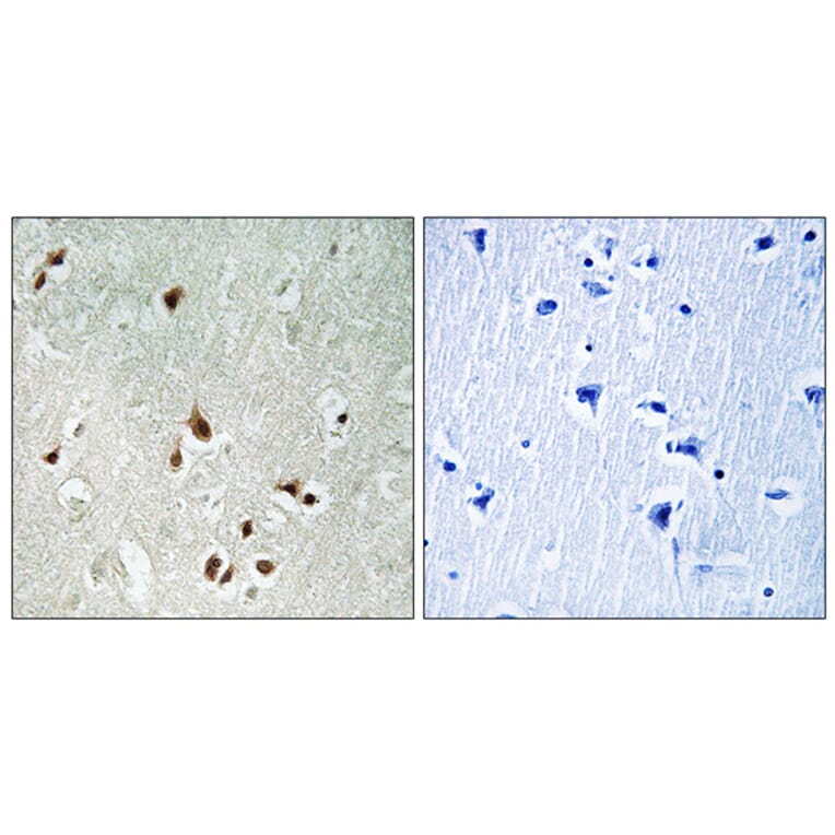 Immunohistochemistry - Anti-HDAC5 Antibody (B0436) - Antibodies.com