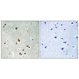 Immunohistochemistry - Anti-HDAC5 Antibody (B0436) - Antibodies.com