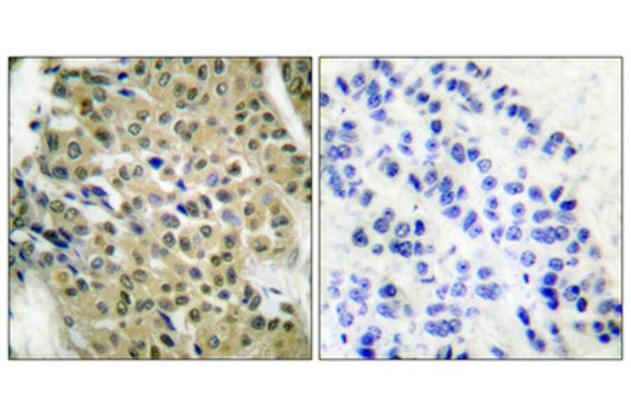 Immunohistochemistry - Anti-HDAC5 Antibody (B0436) - Antibodies.com