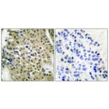 Immunohistochemistry - Anti-HDAC5 Antibody (B0436) - Antibodies.com