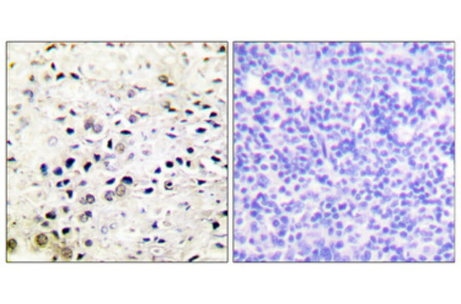 Immunohistochemistry - Anti-HDAC5 Antibody (B0436) - Antibodies.com
