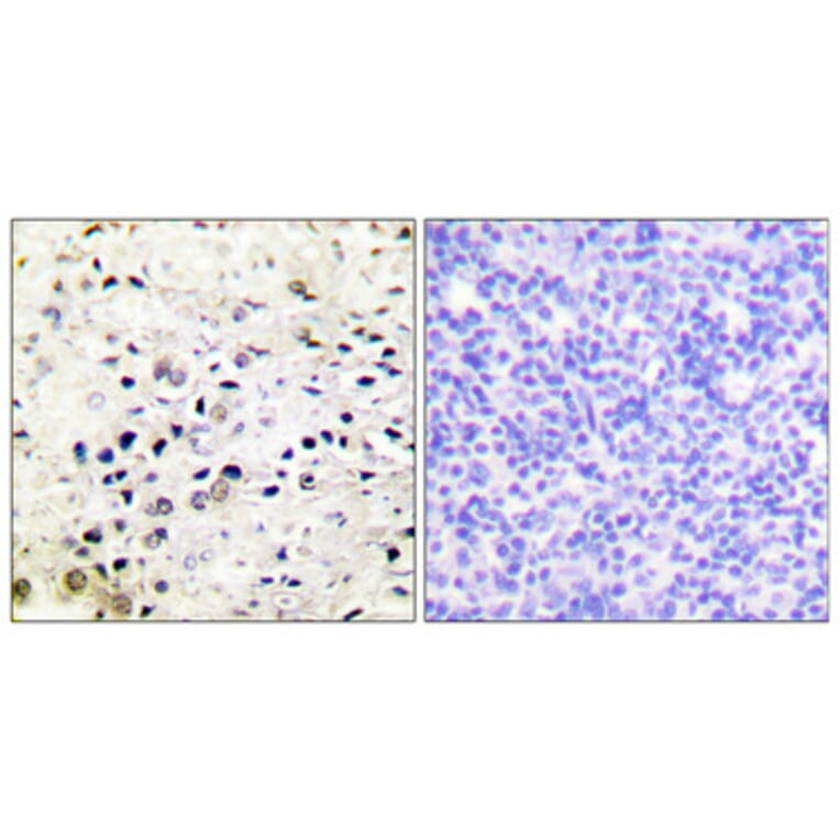 Immunohistochemistry - Anti-HDAC5 Antibody (B0436) - Antibodies.com