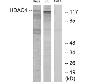 Western Blot - Anti-HDAC4 Antibody (B7100) - Antibodies.com