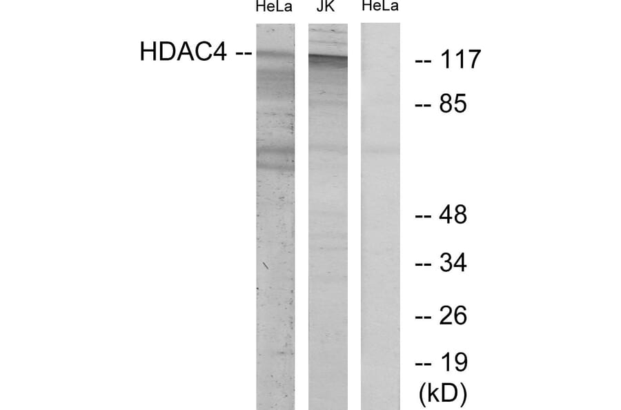 Western Blot - Anti-HDAC4 Antibody (B7100) - Antibodies.com