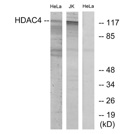 Western Blot - Anti-HDAC4 Antibody (B7100) - Antibodies.com