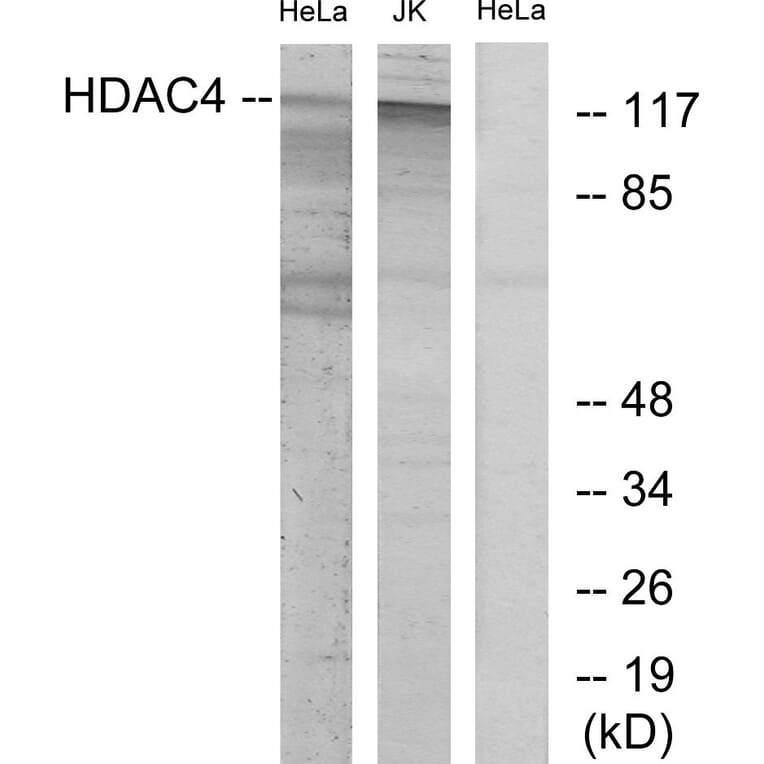 Western Blot - Anti-HDAC4 Antibody (B7100) - Antibodies.com
