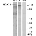 Western Blot - Anti-HDAC4 Antibody (B7100) - Antibodies.com