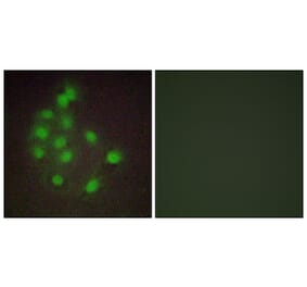 Immunofluorescence - Anti-HAND1 Antibody (C10253) - Antibodies.com
