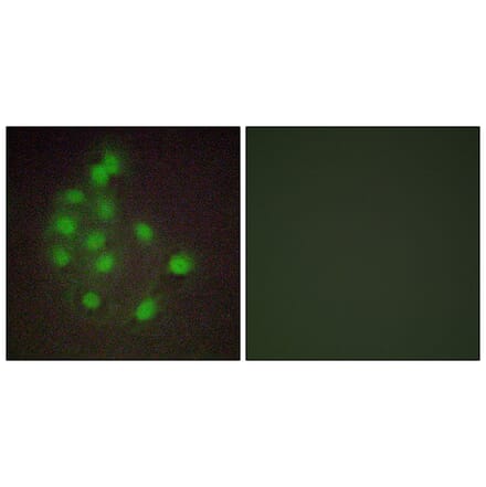 Immunofluorescence - Anti-HAND1 Antibody (C10253) - Antibodies.com