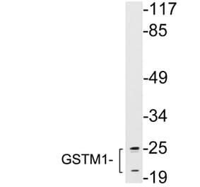 Western Blot - Anti-GSTM1 Antibody (R12-2174) - Antibodies.com