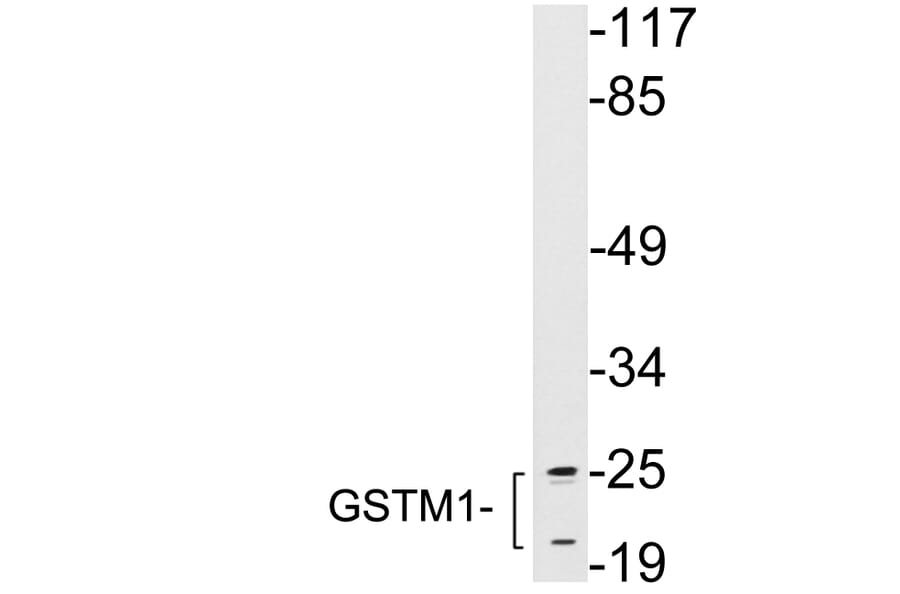Western Blot - Anti-GSTM1 Antibody (R12-2174) - Antibodies.com