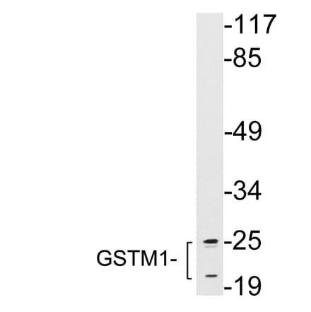 Western Blot - Anti-GSTM1 Antibody (R12-2174) - Antibodies.com