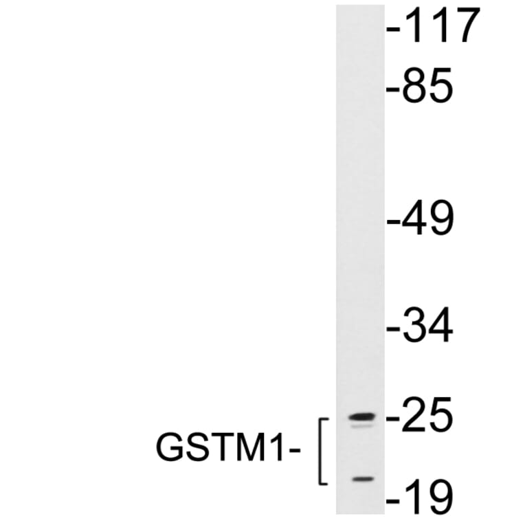 Western Blot - Anti-GSTM1 Antibody (R12-2174) - Antibodies.com