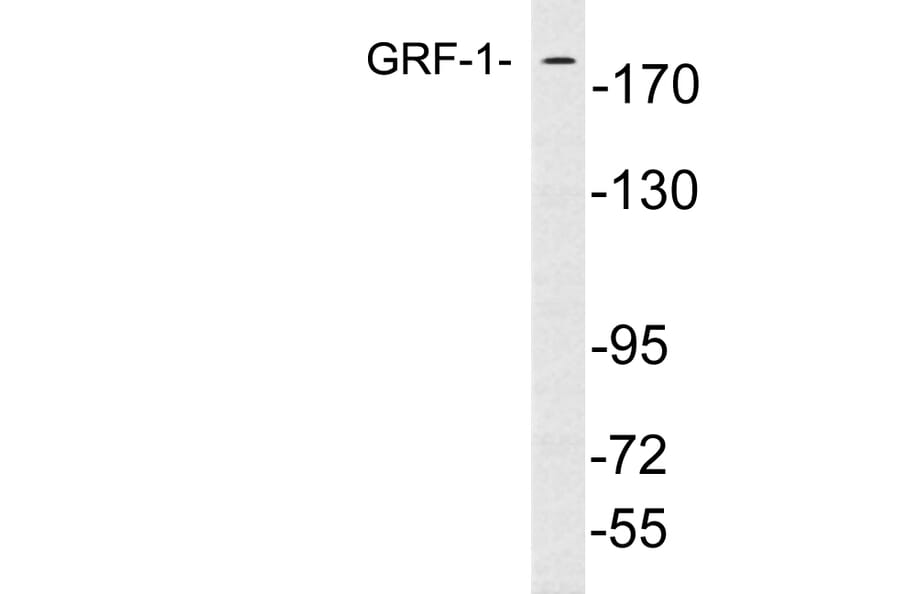 Western Blot - Anti-GRF-1 Antibody (R12-2170) - Antibodies.com
