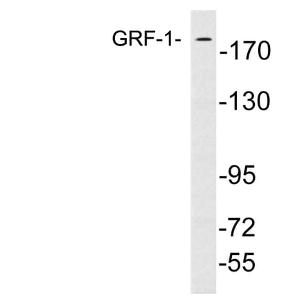 Western Blot - Anti-GRF-1 Antibody (R12-2170) - Antibodies.com