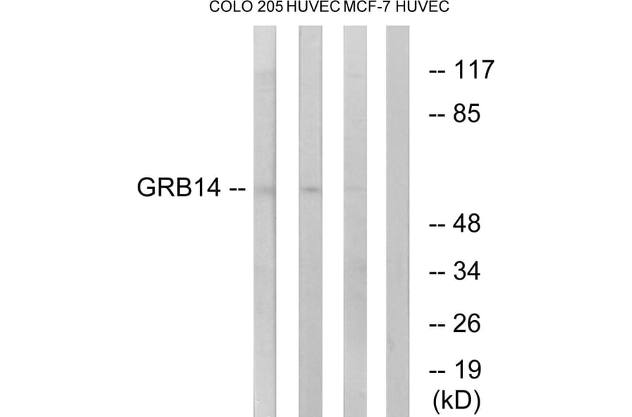 Western Blot - Anti-GRB14 Antibody (C15971) - Antibodies.com