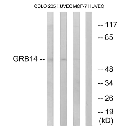 Western Blot - Anti-GRB14 Antibody (C15971) - Antibodies.com