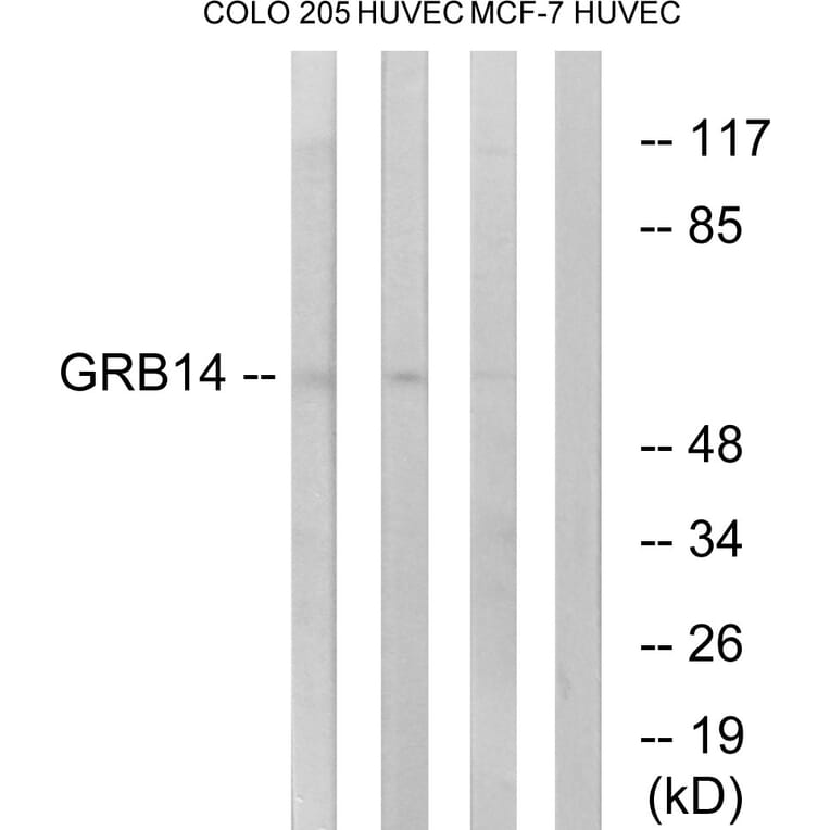 Western Blot - Anti-GRB14 Antibody (C15971) - Antibodies.com