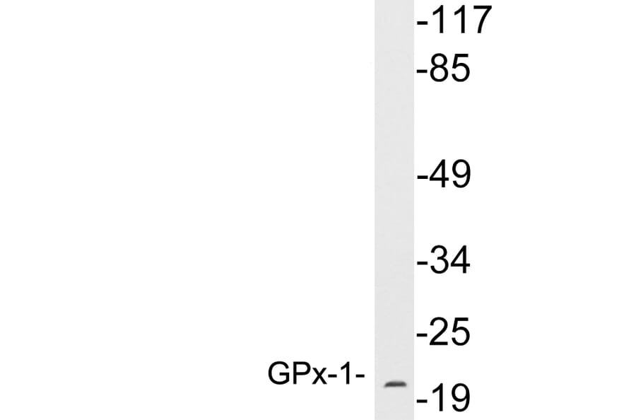 Western Blot - Anti-GPx-1 Antibody (R12-2169) - Antibodies.com