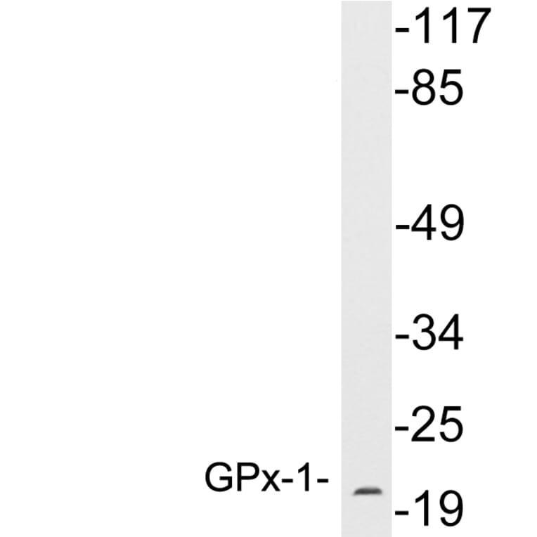 Western Blot - Anti-GPx-1 Antibody (R12-2169) - Antibodies.com