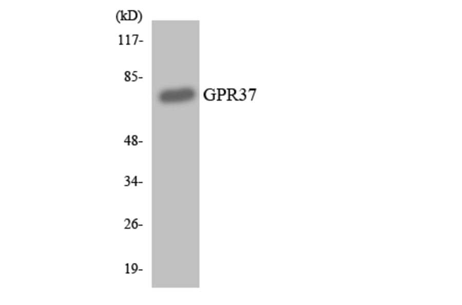 Western Blot - Anti-GPR37 Antibody (R12-2846) - Antibodies.com