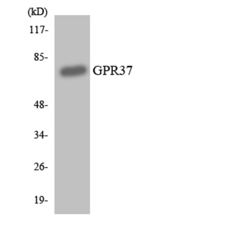 Western Blot - Anti-GPR37 Antibody (R12-2846) - Antibodies.com