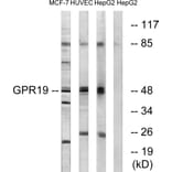 Western Blot - Anti-GPR19 Antibody (G327) - Antibodies.com