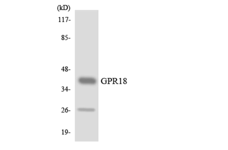 Western Blot - Anti-GPR18 Antibody (R12-2842) - Antibodies.com
