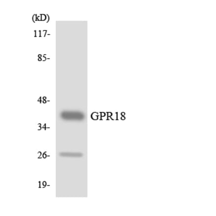 Western Blot - Anti-GPR18 Antibody (R12-2842) - Antibodies.com