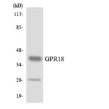 Western Blot - Anti-GPR18 Antibody (R12-2842) - Antibodies.com