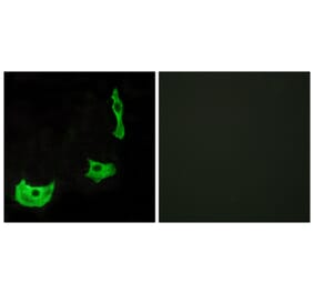 Immunofluorescence - Anti-GPR17 Antibody (G142) - Antibodies.com