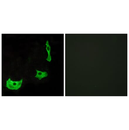 Immunofluorescence - Anti-GPR17 Antibody (G142) - Antibodies.com