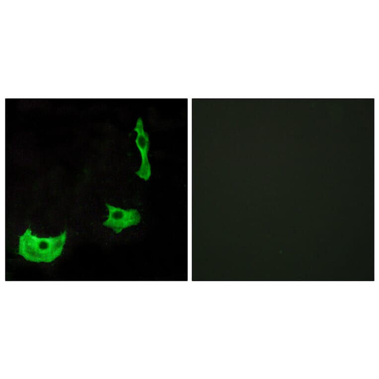 Immunofluorescence - Anti-GPR17 Antibody (G142) - Antibodies.com