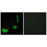 Immunofluorescence - Anti-GPR17 Antibody (G142) - Antibodies.com