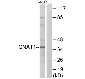 Western Blot - Anti-GNAT1 Antibody (C16062) - Antibodies.com