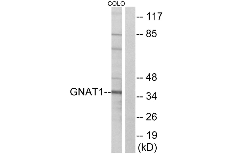Western Blot - Anti-GNAT1 Antibody (C16062) - Antibodies.com